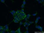 GPX3 Antibody in Immunocytochemistry (ICC/IF)