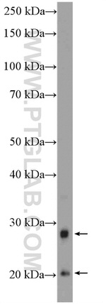 GPX3 Antibody in Western Blot (WB)