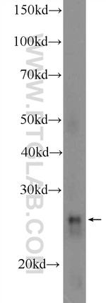 GPX3 Antibody in Western Blot (WB)