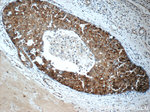 MAPKAPK2 Antibody in Immunohistochemistry (Paraffin) (IHC (P))
