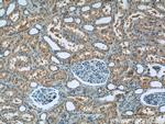 MAPKAPK2 Antibody in Immunohistochemistry (Paraffin) (IHC (P))