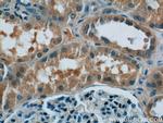 MAPKAPK2 Antibody in Immunohistochemistry (Paraffin) (IHC (P))