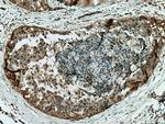 MAPKAPK2 Antibody in Immunohistochemistry (Paraffin) (IHC (P))