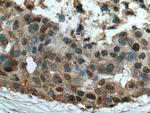 MAPKAPK2 Antibody in Immunohistochemistry (Paraffin) (IHC (P))