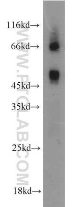 MAPKAPK2 Antibody in Western Blot (WB)