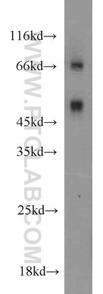 MAPKAPK2 Antibody in Western Blot (WB)