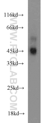 MAPKAPK2 Antibody in Western Blot (WB)