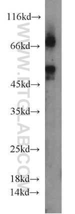 MAPKAPK2 Antibody in Western Blot (WB)