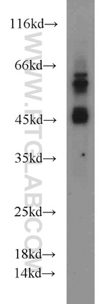 MAPKAPK2 Antibody in Western Blot (WB)