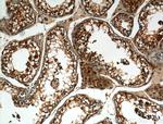 ALDH1A2 Antibody in Immunohistochemistry (Paraffin) (IHC (P))