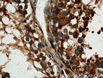ALDH1A2 Antibody in Immunohistochemistry (Paraffin) (IHC (P))