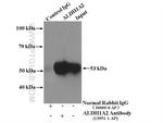 ALDH1A2 Antibody in Immunoprecipitation (IP)