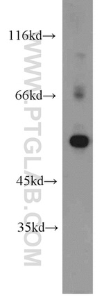 ALDH1A2 Antibody in Western Blot (WB)
