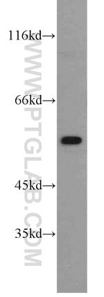 ALDH1A2 Antibody in Western Blot (WB)