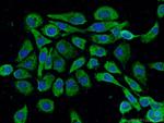 PPFIBP2 Antibody in Immunocytochemistry (ICC/IF)
