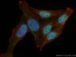 Chk2 Antibody in Immunocytochemistry (ICC/IF)