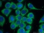 Chk2 Antibody in Immunocytochemistry (ICC/IF)