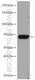 Chk2 Antibody in Western Blot (WB)