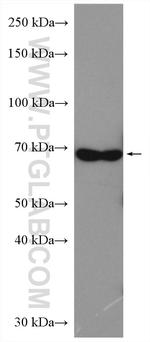 Chk2 Antibody in Western Blot (WB)