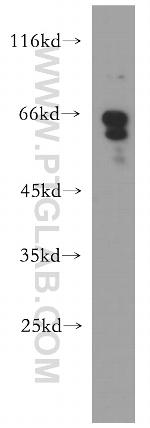 Chk2 Antibody in Western Blot (WB)