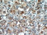 CD43 Antibody in Immunohistochemistry (Paraffin) (IHC (P))