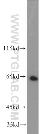 CD43 Antibody in Western Blot (WB)