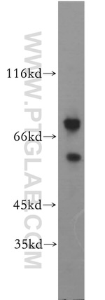CD43 Antibody in Western Blot (WB)
