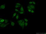 PPFIBP1 Antibody in Immunocytochemistry (ICC/IF)