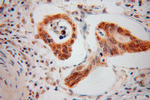 PPFIBP1 Antibody in Immunohistochemistry (Paraffin) (IHC (P))