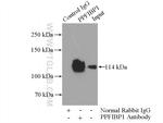 PPFIBP1 Antibody in Immunoprecipitation (IP)