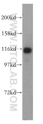 PPFIBP1 Antibody in Western Blot (WB)