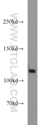 PPFIBP1 Antibody in Western Blot (WB)