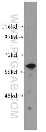 KPNA5 Antibody in Western Blot (WB)