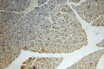 IFT88 Antibody in Immunohistochemistry (Paraffin) (IHC (P))