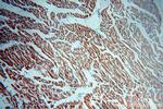 IFT88 Antibody in Immunohistochemistry (Paraffin) (IHC (P))