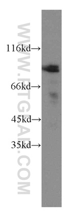 IFT88 Antibody in Western Blot (WB)
