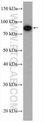 IFT88 Antibody in Western Blot (WB)