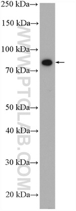 IFT88 Antibody in Western Blot (WB)