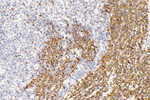 alpha Catenin Antibody in Immunocytochemistry (ICC/IF)