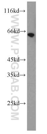 Calicin Antibody in Western Blot (WB)