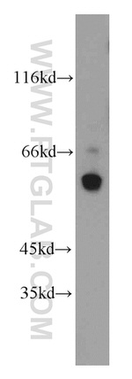 Calicin Antibody in Western Blot (WB)