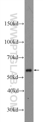 Calicin Antibody in Western Blot (WB)