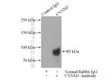 CNNM3 Antibody in Immunoprecipitation (IP)