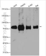 CNNM3 Antibody in Western Blot (WB)