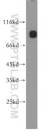 CNNM3 Antibody in Western Blot (WB)