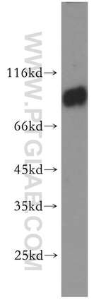 CNNM3 Antibody in Western Blot (WB)
