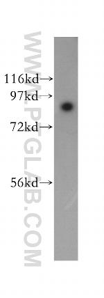 SEC63 Antibody in Western Blot (WB)