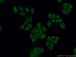 TLK2 Antibody in Immunocytochemistry (ICC/IF)