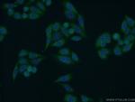 TLK2 Antibody in Immunocytochemistry (ICC/IF)