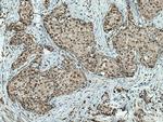 TLK2 Antibody in Immunohistochemistry (Paraffin) (IHC (P))